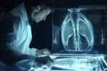 AI Model Shows High Accuracy in Detecting Endometrial Cancer Researchers Report